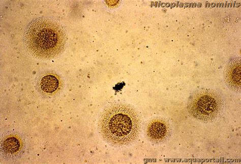 mycoplasma hominis-4